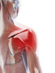 shoulder pain when lifting arm