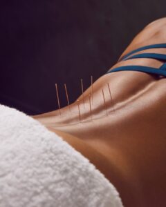 Dry Needling Jupiter
Dry Needling Near Jupiter
Sports Recovery Jupiter FL